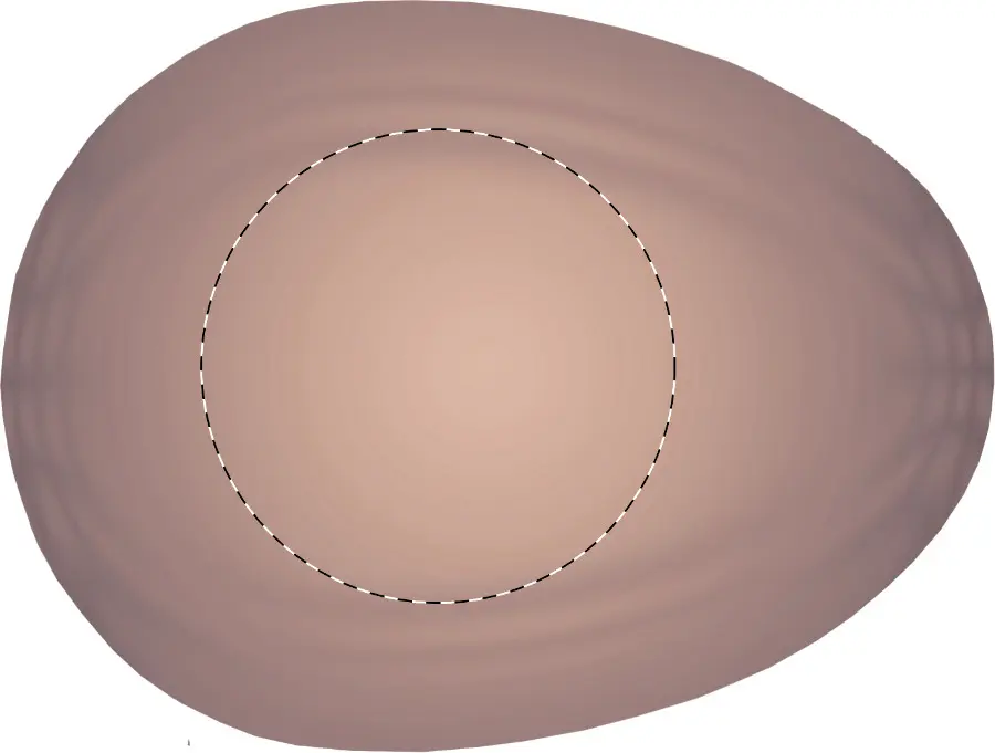 Pad printing – Top